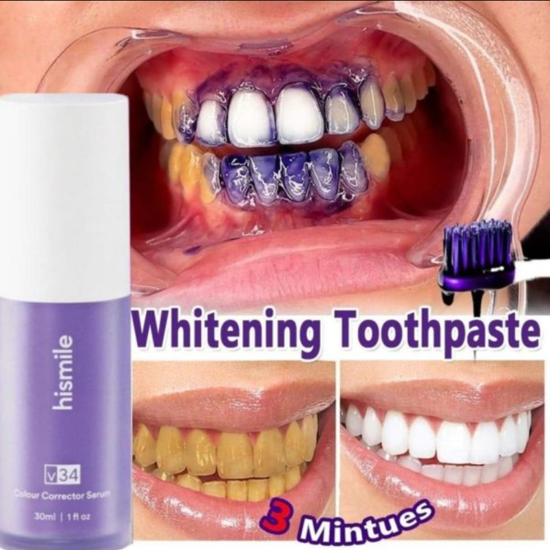 HiSmile V34 Teeth Whitener Serum